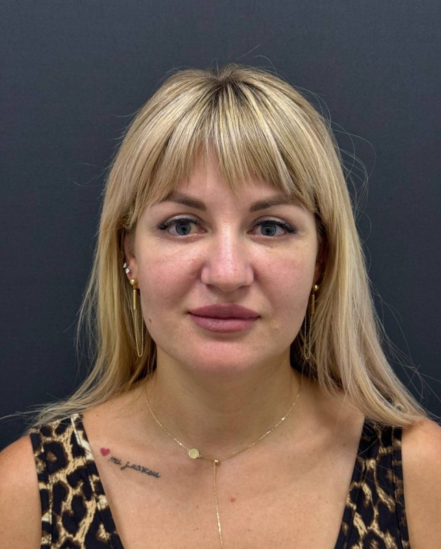 lytsevi protsedury main